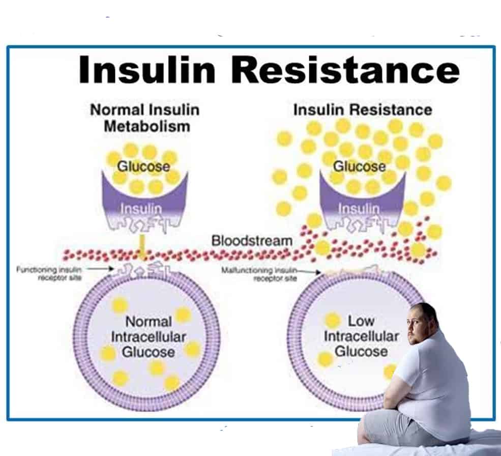 insulin-resisten